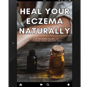 Heal Your Eczema Naturally